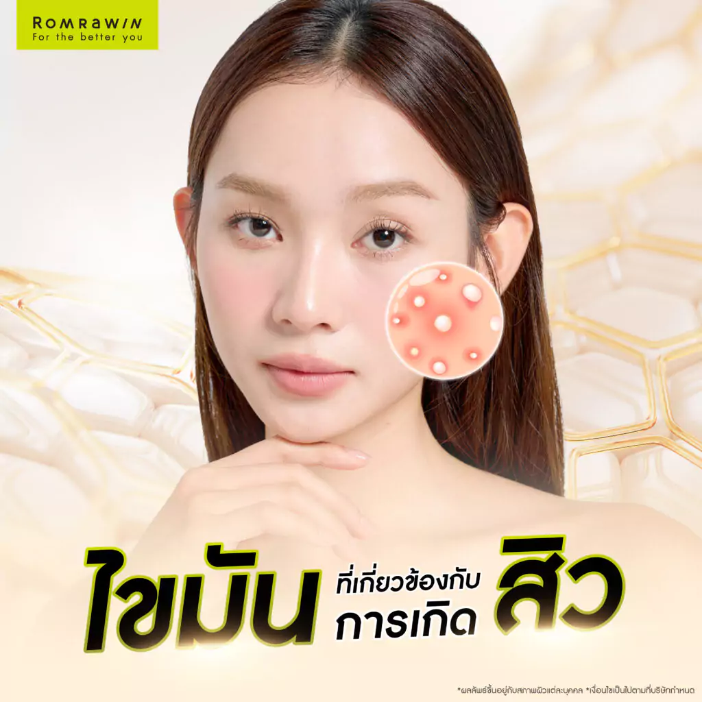 ไขมันใต้ผิวหนัง ปัจจัยแฝงที่ทำทำให้เกิดสิว 3 ไขมันที่เกี่ยวข้องกับการเกิดสิว