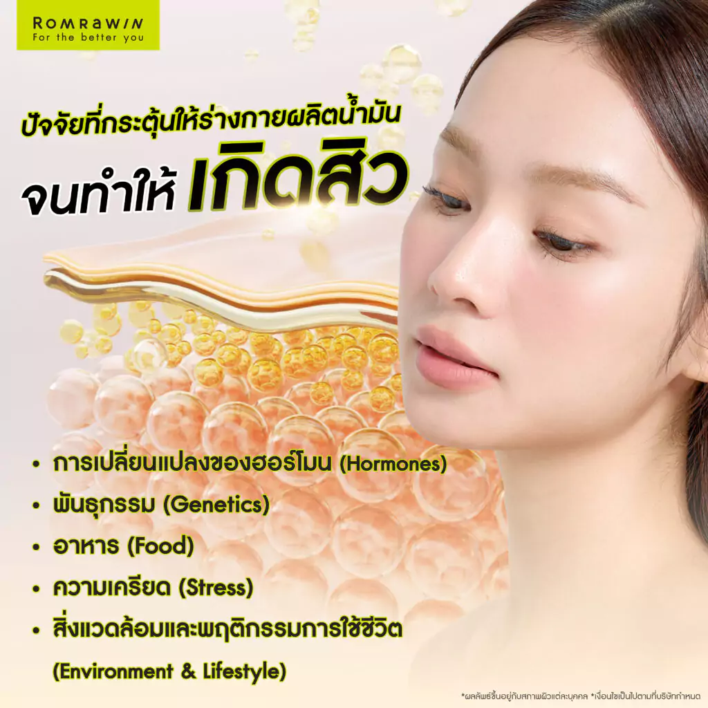 ไขมันใต้ผิวหนัง ปัจจัยแฝงที่ทำทำให้เกิดสิว 6 ปัจจัยที่กระตุ้นให้ร่างกายผลิตน้ำมันจนทำให้เกิดสิว