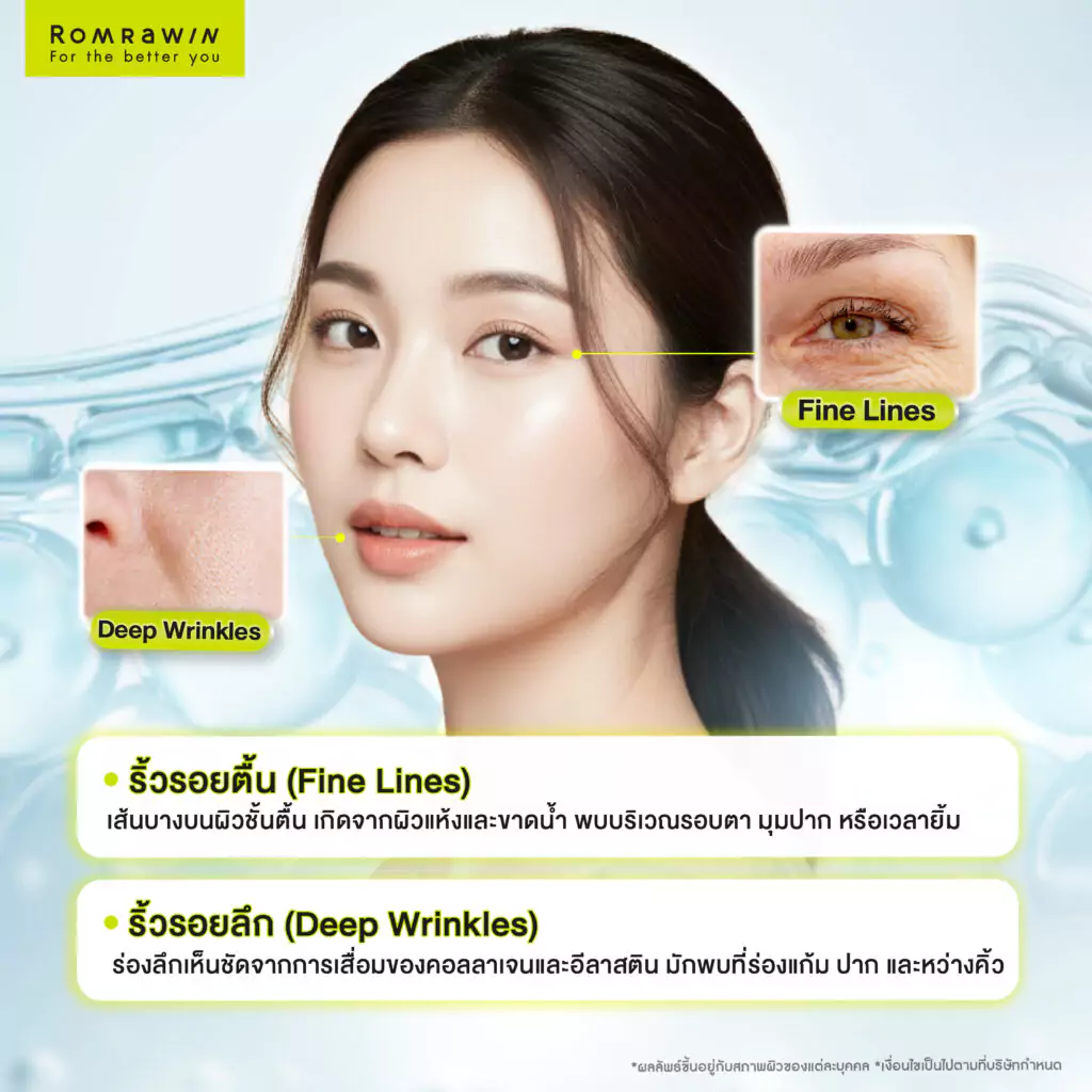 รอยเหี่ยวย่นเกิดจากอะไร? สาเหตุและวิธีดูแลผิวให้ดูอ่อนวัย 3 ประเภทของริ้วรอยบนใบหน้า