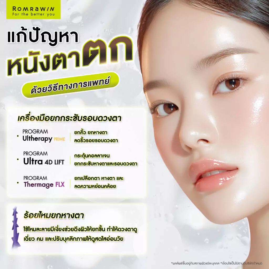 หนังตาตก แก้ปัญหาอย่างไร รวมวิธีดูแลดวงตากลับมาดูสดใสอีกครั้ง 5 หนังตาตก แก้ปัญหาอย่างไร รวมวิธีดูแลดวงตากลับมาดูสดใสอีกครั้ง