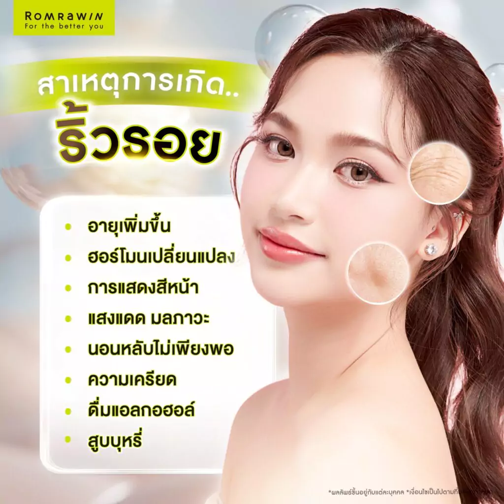 วิธีป้องกันริ้วรอยก่อนวัยมีอะไรบ้าง? รวมเคล็ดลับเพื่อผิวอ่อนกว่าวัย 4 สาเหตุของการเกิดริ้วรอย