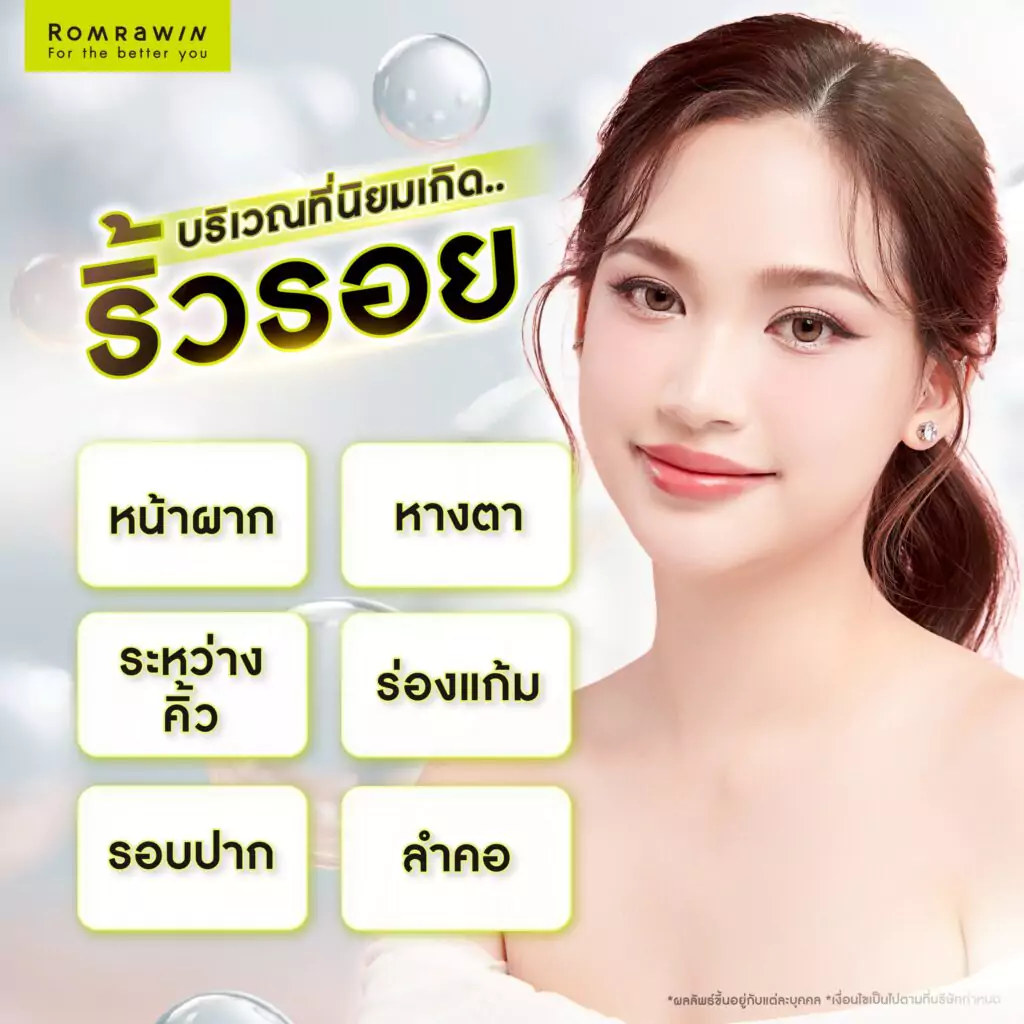 วิธีป้องกันริ้วรอยก่อนวัยมีอะไรบ้าง? รวมเคล็ดลับเพื่อผิวอ่อนกว่าวัย 5 บริเวณที่นิยมเกิดริ้วรอยบ่อย